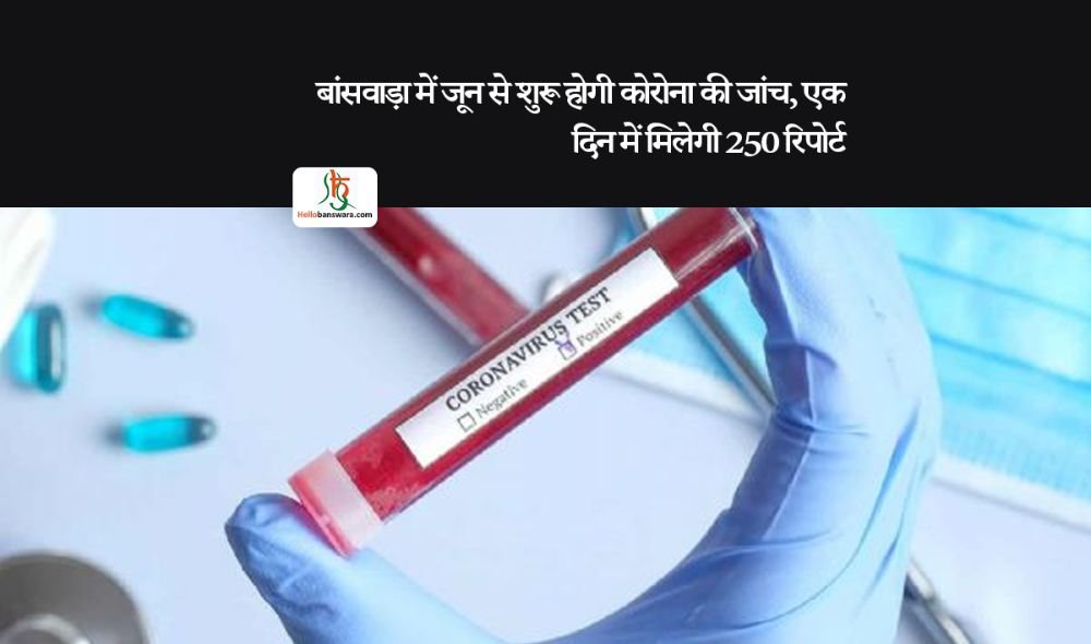 बांसवाड़ा में जून से शुरू हाेगी काेराेना की जांच, एक दिन में मिलेगी 250 रिपाेर्ट
